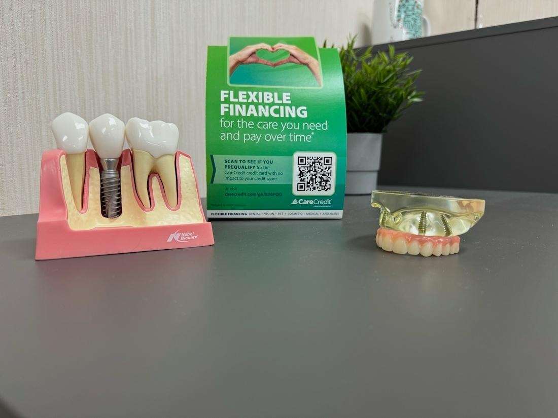 dental implants west allis | implants display at office