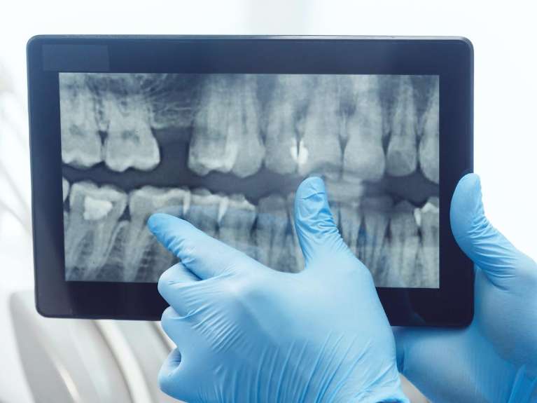 dental exam west allis | digital dental x-rays