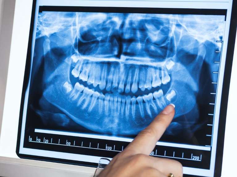 dental exam west allis | panoramic dental x-rays